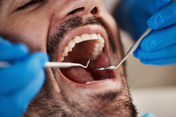 Best Tooth Infection Emergency Dentist  in Pennsburg, PA