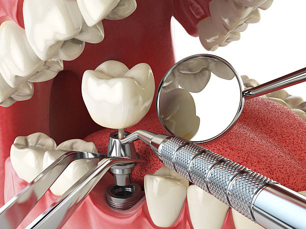Best Knocked-Out Tooth Emergency  in Pennsburg, PA